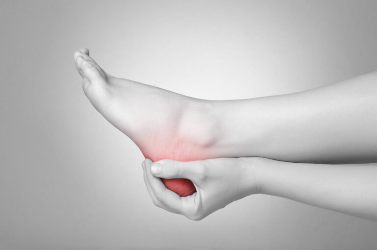 plantar fasciitis - feet issue