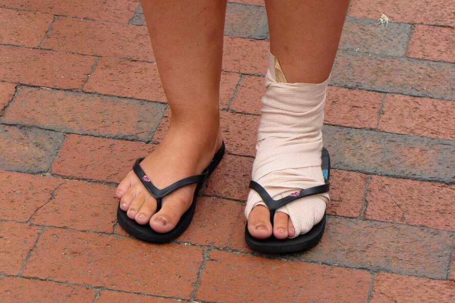 Woman with bandaged foot and ankle